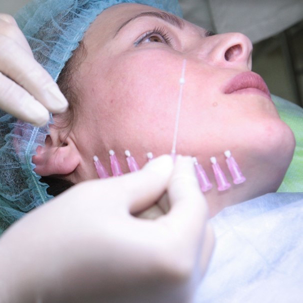 Тредлифтинг мезонитями - подтяжка и коррекция лица мезонитями.