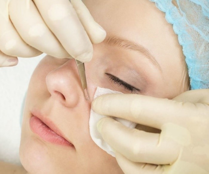 Ручная механическая чистка лица