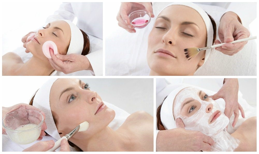 Химический пилинг