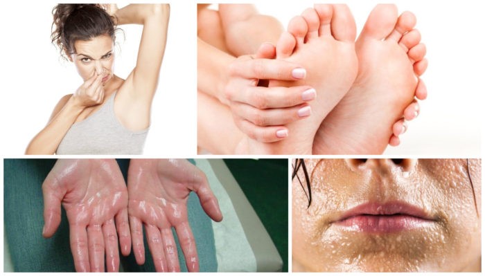 Основные виды локализованного гипергидроза