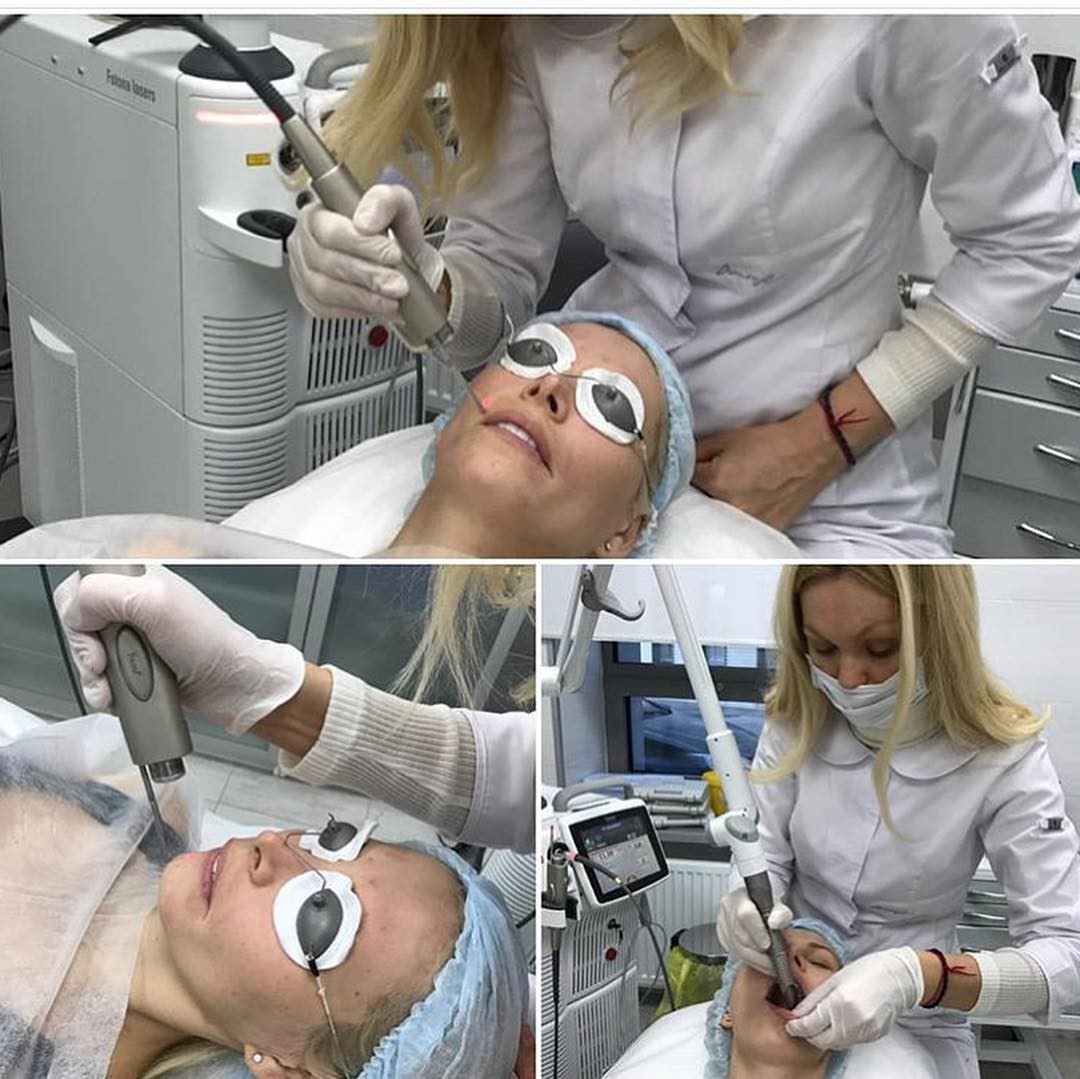 Процедура 4D-омоложения в клинике КосметоМед