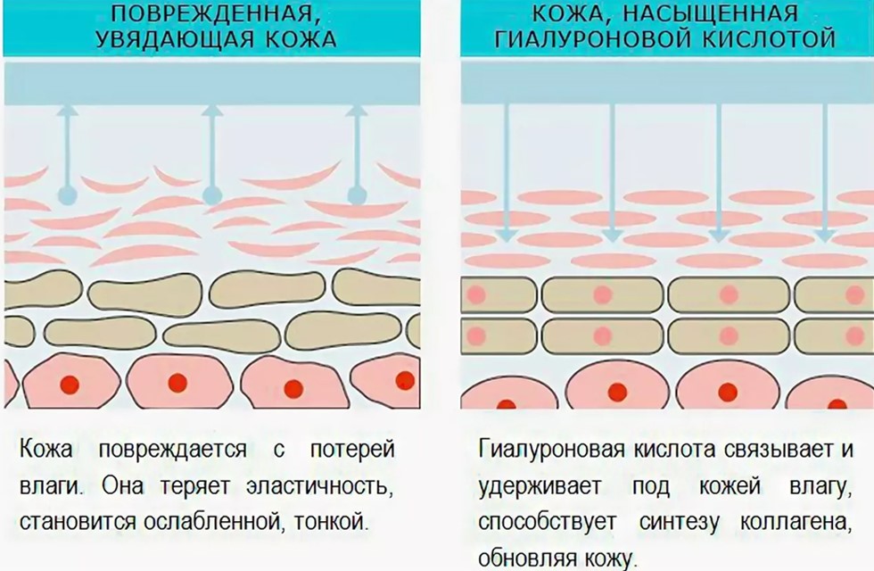 Биоревитализация