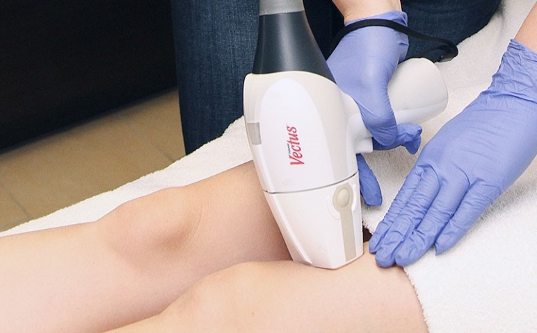 Эпиляция волос